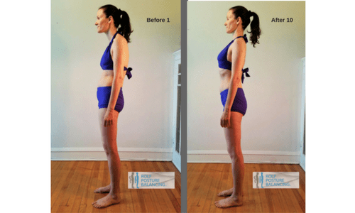 Rolf Method Structural Integration Before and After 10 Series Pictures Philip Clampitt